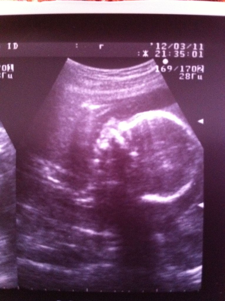 Настья Прилепина NB | Армавир