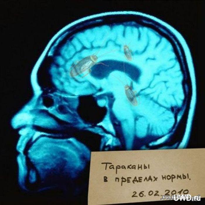 Емма Плавиванзос | Киев