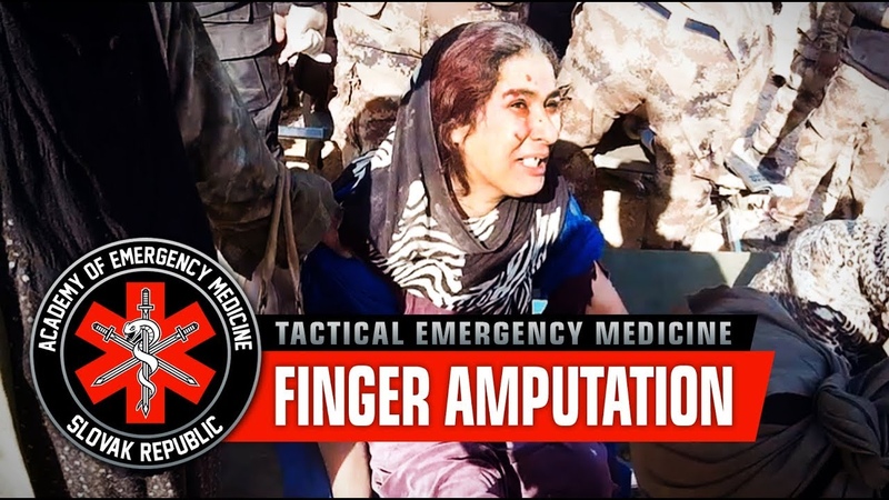 Local woman with Amputation, War in Iraq, Mosul offensive ( Graphic