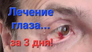 Лечение глаза